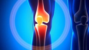 March 28, 2026 | Knee Injuries From Car Accidents Knee injuries from car accidents car accident