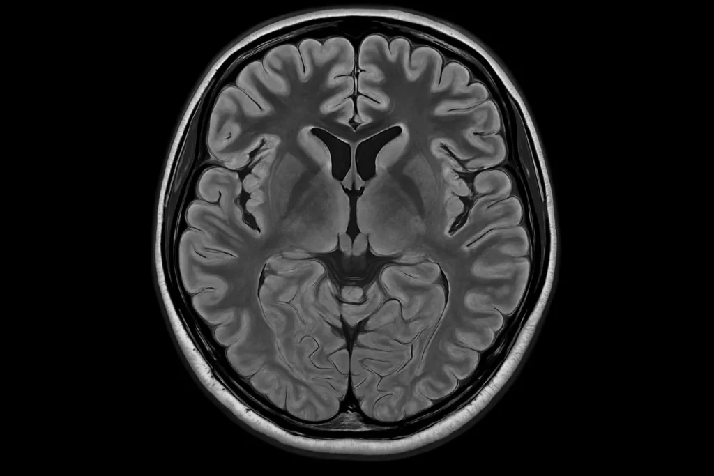 Reading an mri report
