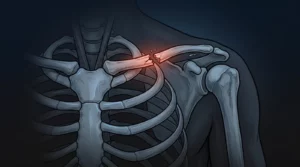 May 2, 2026 | sam aguiar injury lawyers | official site