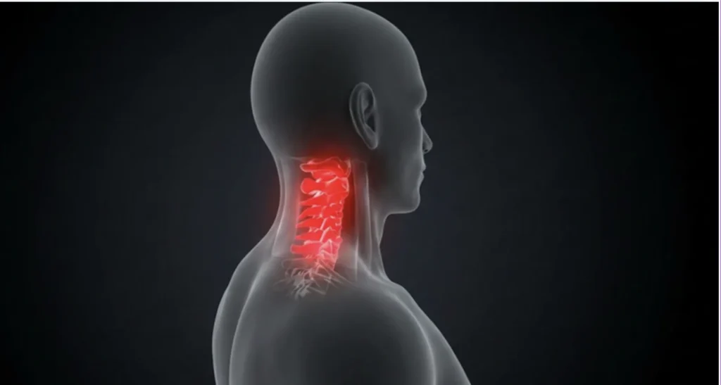 Spine injuries from car accidents