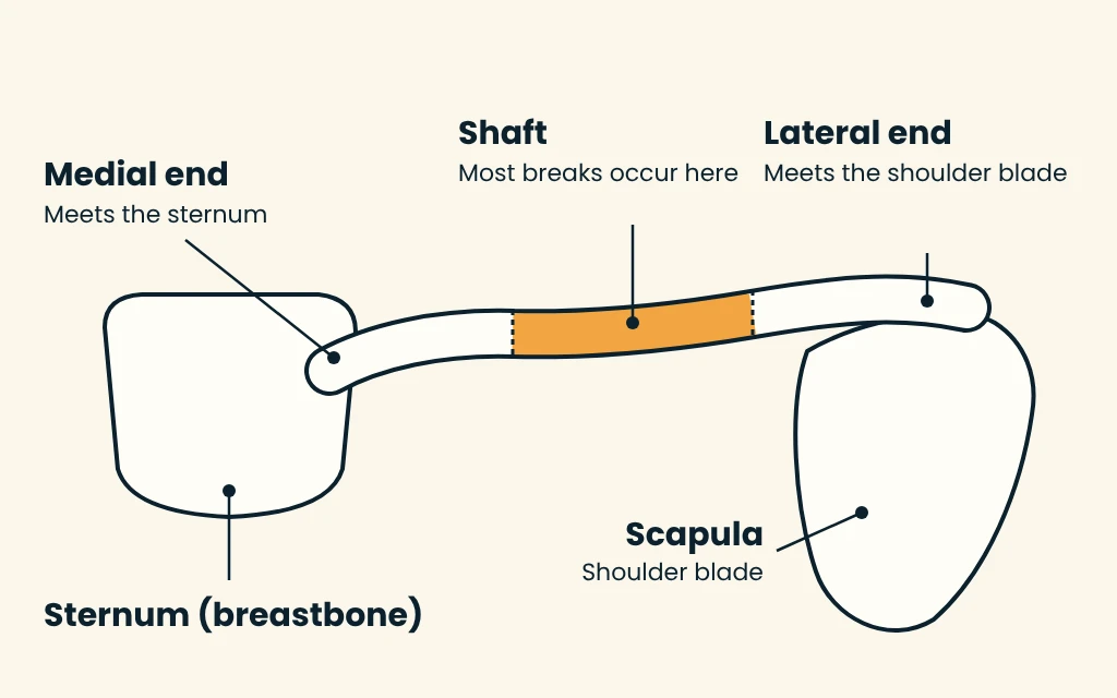 Simplified diagram of the collarbone running from the breastbone to the shoulder blade, with the shaft shaded orange and the medial end, lateral end, sternum and scapula labeled