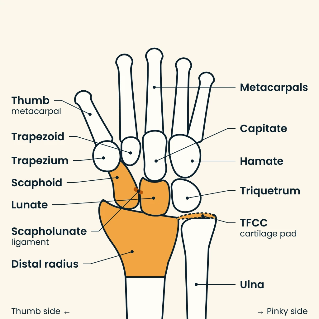 Labeled line drawing of the wrist bones seen from the back of the right hand, with the distal radius, scaphoid, lunate, scapholunate ligament and TFCC shaded orange